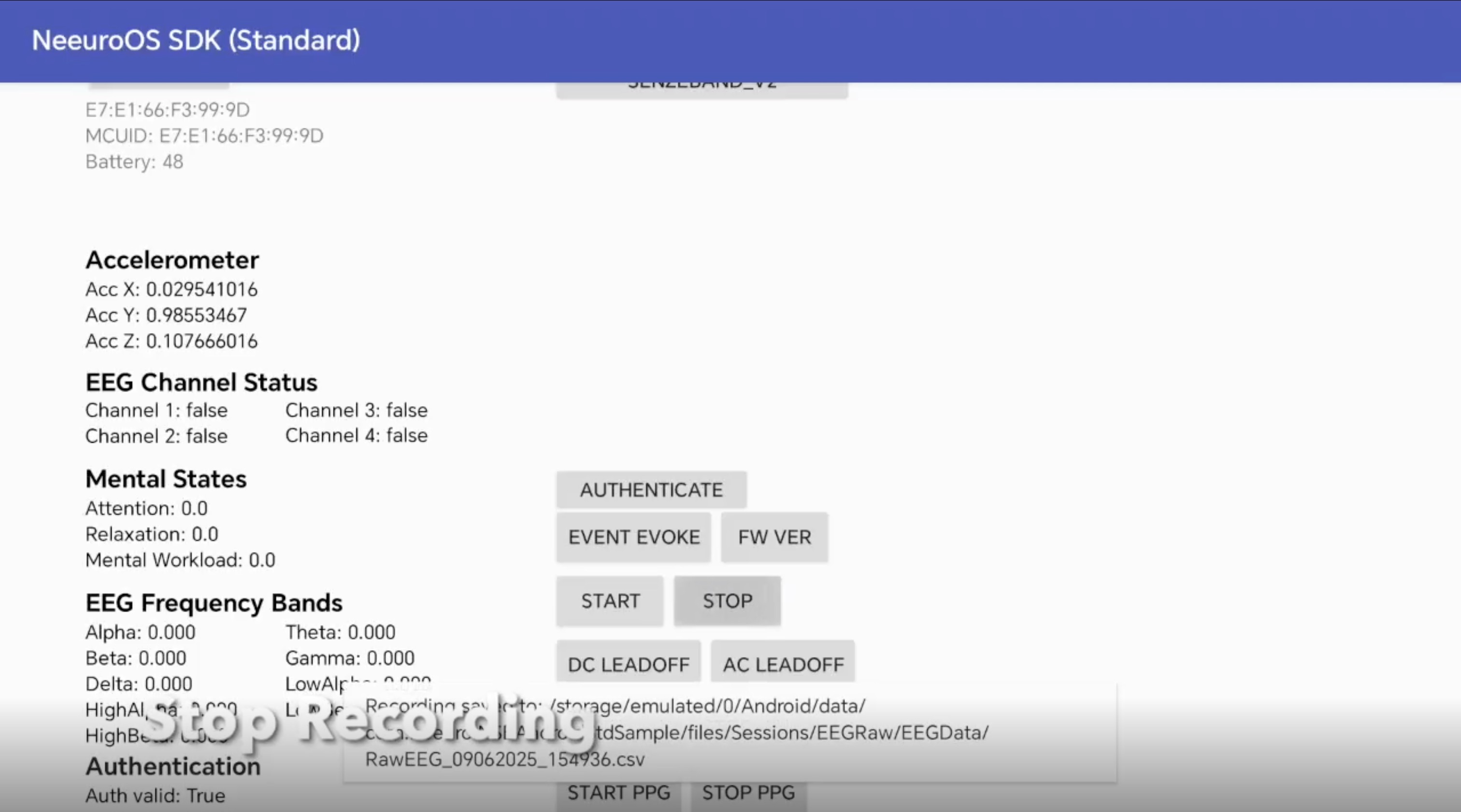 Image of Android SDK stop recording