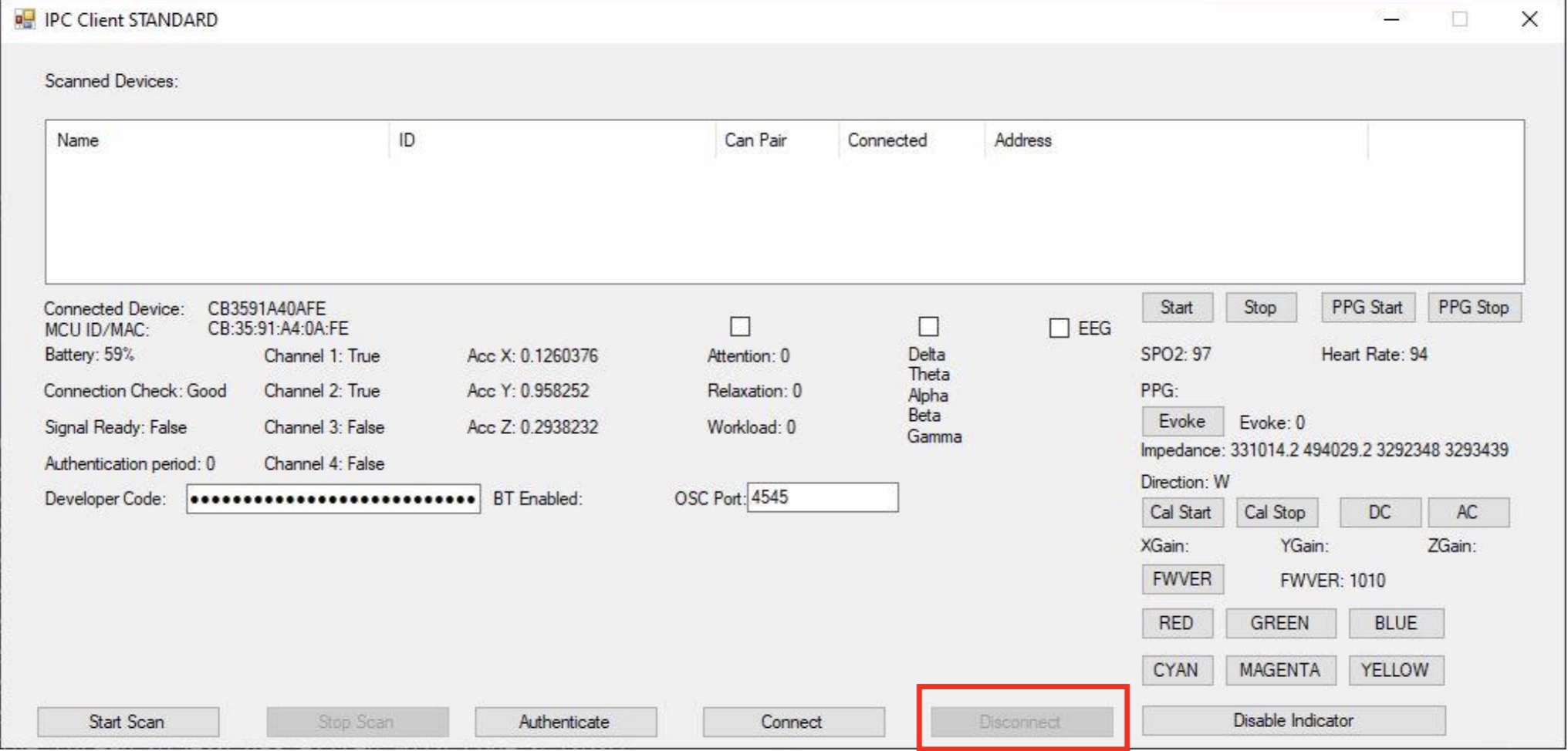 Image of how to Disconnect the SenzeBand