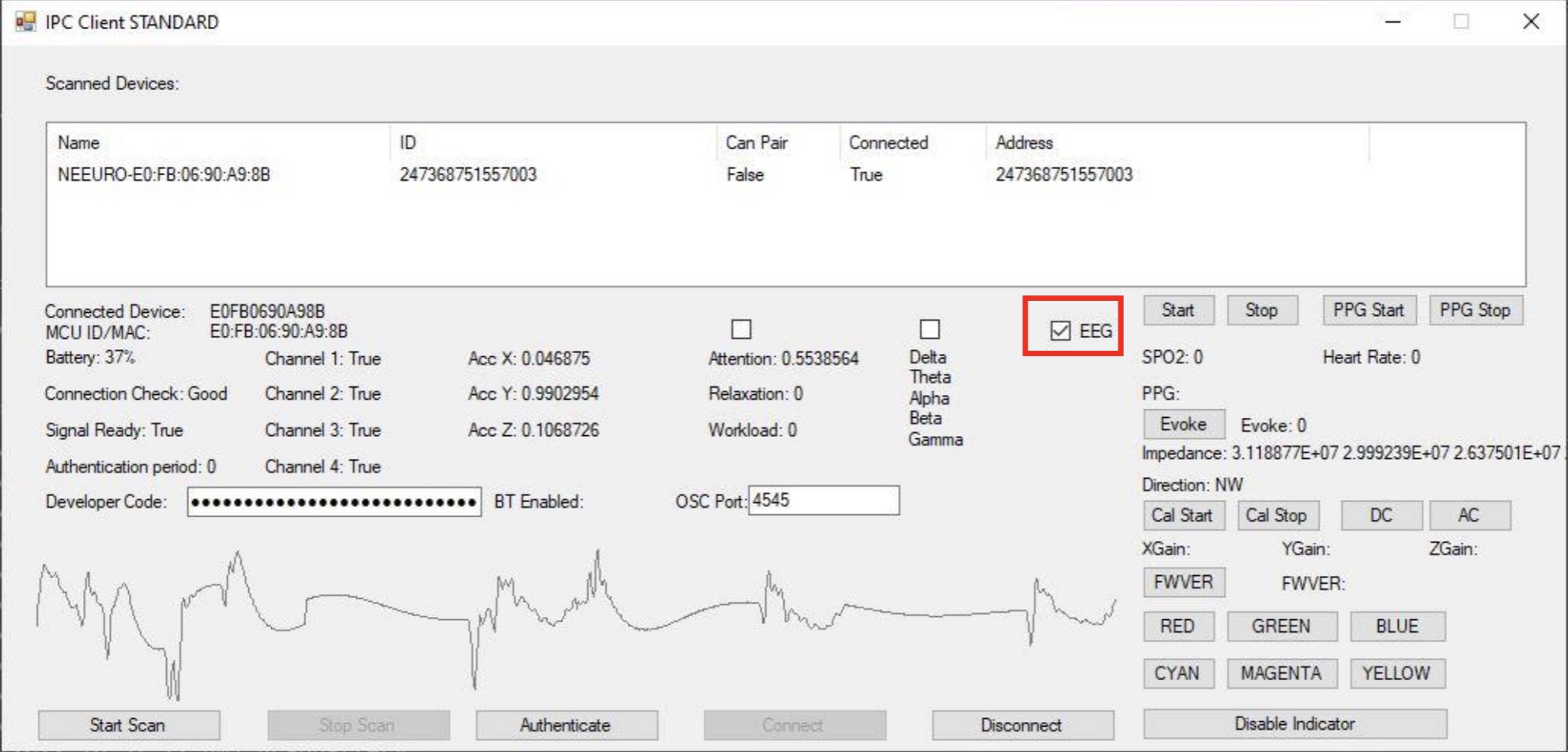 Image of how to view EEG graph