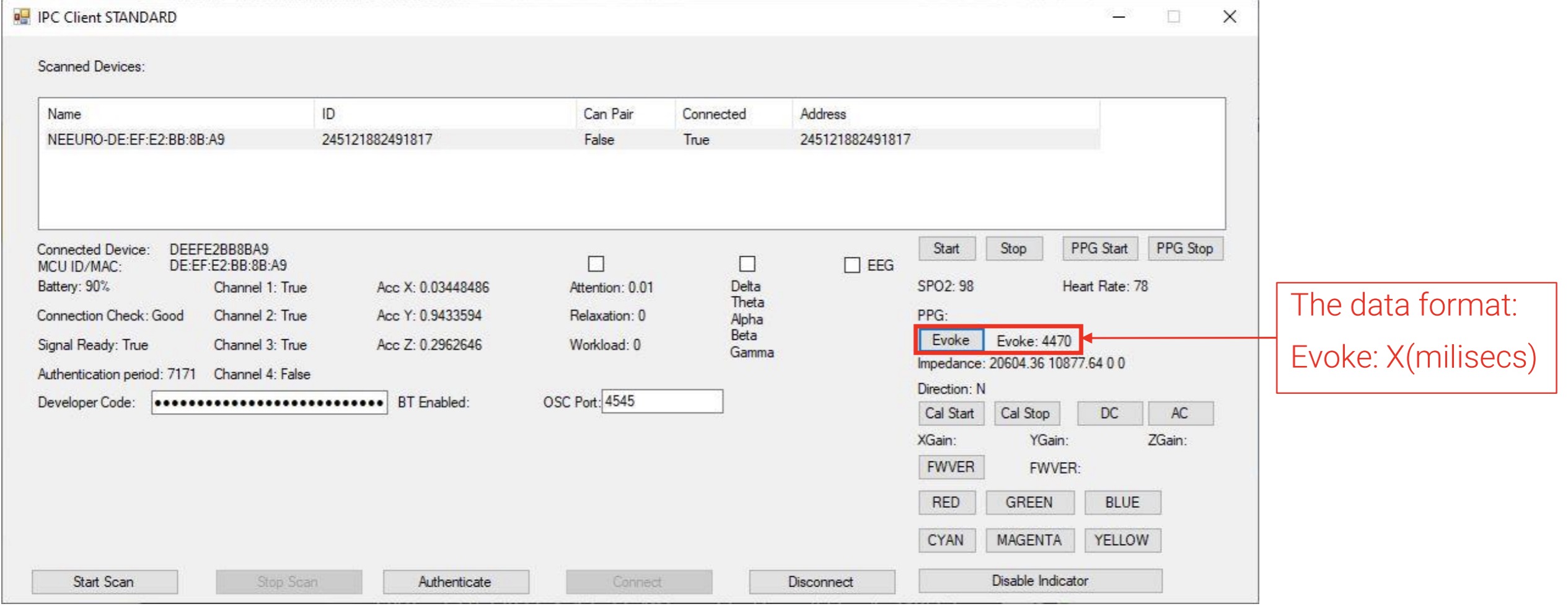 Image of how to Evoke SenzeBand