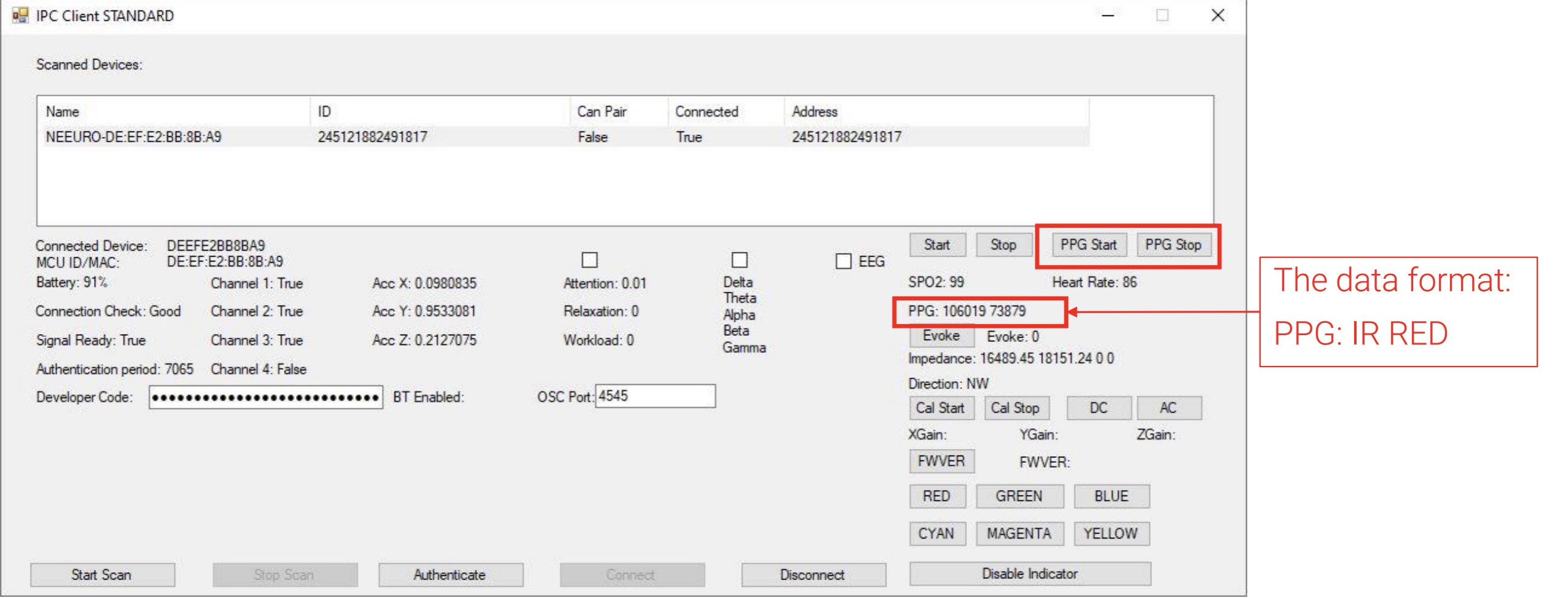 Image of how to PPG Start and PPG Stop on SenzeBand